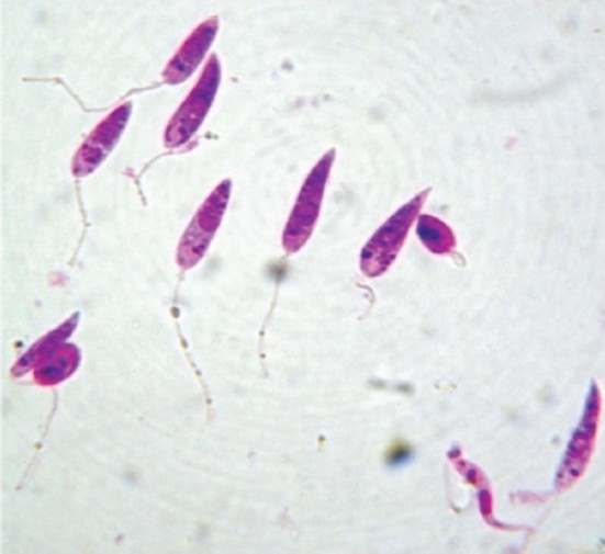 Stained promastigotes (100 X under oil immersion lens).