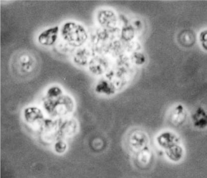 Axenic amastigotes (100 X under oil immersion lens).