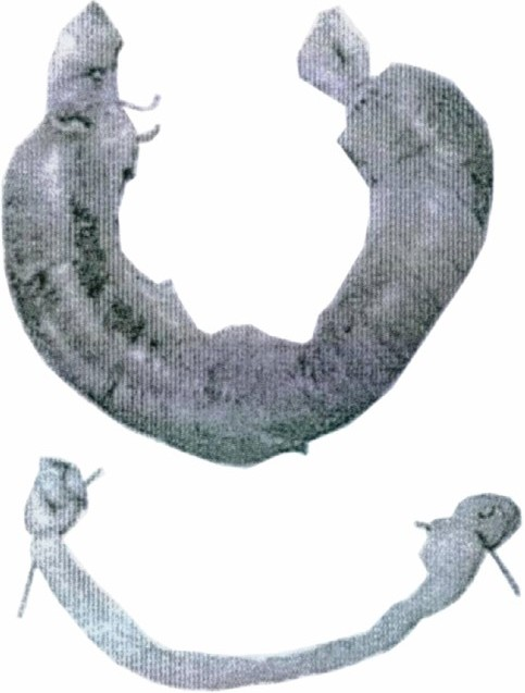 Gross appearance of ligated loops of small intestine from rabbits 24 h after injection with cultures of Bacterium coli grown at pH 8.4. Upper loop injection with a culture of pathogenic Bact. coli; lower loop with non-pathogenic Bact. coli. Reproduced from reference 3 with permission.