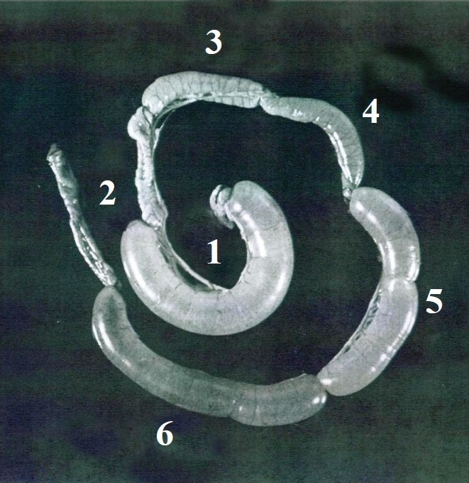 Titrations of E. coli culture filtrates in the RIL assay. Loops 1 and 2 represent positive (V. cholerae enterotoxin) and negative (saline) controls, respectively. Loops 6, 5, 4, and 3 show results obtained with increasing dilutions of the ETEC culture filtrates. Done in author’s laboratory.