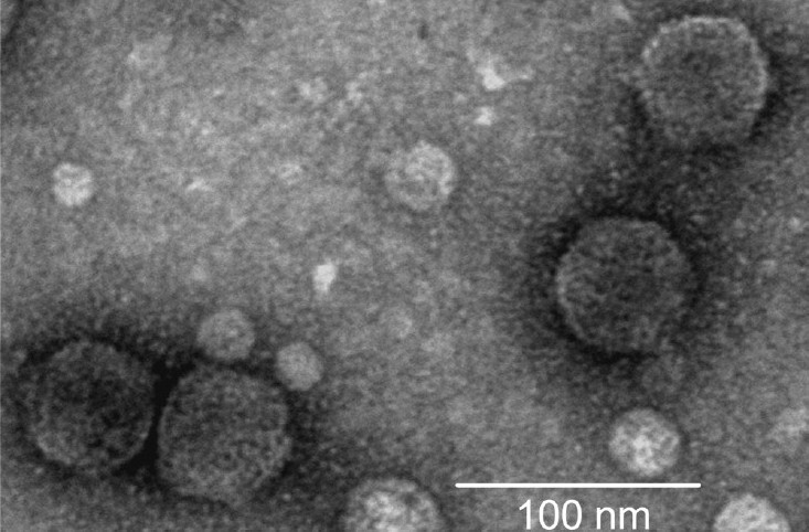 Electron micrograph of phage JSF9. The phage has a hexagonal head and a short tail, and belongs to the family Podoviridae.