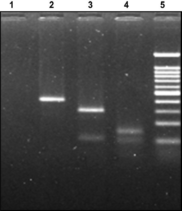 RFLP pattern of Nested product of HCV RNA. RFLP digestion pattern in 2 per cent agarose gel: Genotype 1c infection: Lane: 1 negative control, lane: 2 AccI digested product (394 bp), lane: 3 MboI digested pattern (296 and 106 bp), lane 4: BstNI digested product (159 bp), lane 5: molecular weight marker 100 bp DNA ladder (100, 200, 300, 400, 500, 600, 700, 800, 900, 1000 and 1200).