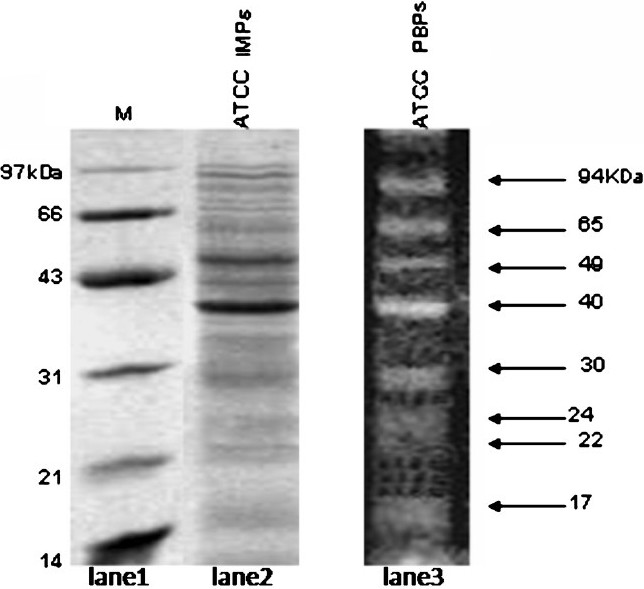 SDS-PAGE analysis of total inner membrane proteins of A. baumannii ATCC 19606. Lane 1, molecular weight marker; lane 2, total inner membrane proteins and lane 3, fluorescent image of Bocillin FL labeled-PBPs (from Fig. 4, lane 1).