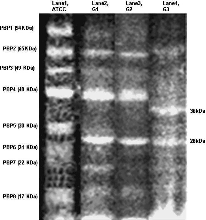 Comparative SDS-PAGE profile of penicillin binding proteins (PBPs) of ATCC and resistant isolates of A. baumanniiusing Bocillin FL. Lanes 1, 2, 3 and 4 represent PBPs of ATCC 19606, G1 (low resistant), G2 (intermediate resistant) and G3 (high resistant), respectively