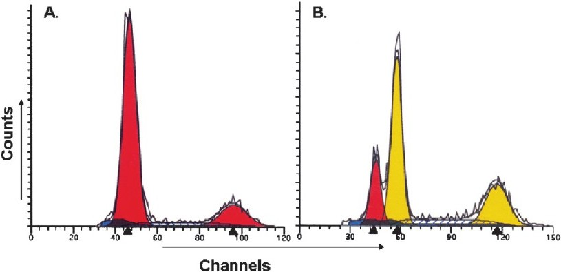 DNA histogram of tobacco-related intraoral squamous cell carcinoma analyzed by ‘Modfit LT’ software, showing (A) diploid tumour (B) aneuploid tumour.