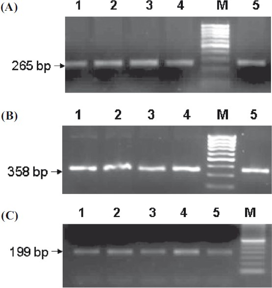 Agarose gels showing PCR products of (A) Exon 3, (B) Exon 4, (C) Exon 5, Lane M:100 and 50 bp ladder.