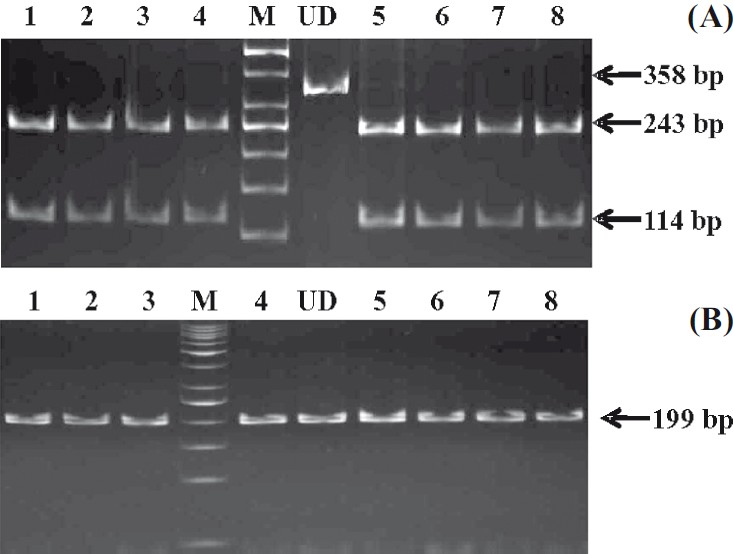 Gel showing 478C>T SNP in exon 4, lane M, 50 bp ladder; lane UD, undigested PCR product; lanes 1-4, 5-8, PCR products digested with Cfr131 showing CC genotype. (B). Gel picture of delAC in exon 5, lane M, 50 bp ladder; lane UD undigested PCR product; lanes 1-3, 4, 5-8, Box I digested PCR products showing -/- genotype.