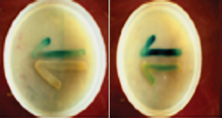 Agar plate cross-feeding assay for screening of acyl homoserine lactone (AHL) production by uroisolates of P. aeruginosa. Evidence for the production of AHL is indicated by blue colouration of the reporter strain E. coli MG4.