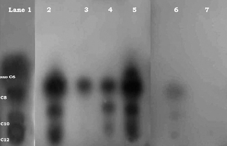 Separation and detection of acyl- HSL standards [mixture of oxo C6 (OHHL), C8 (OOHL), C10 (ODHL) and C12 (OdDHL)] (lane 1), acyl- HSLs produced by uroisolates of P. aeruginosa (lane 2-5) and wild type PAO1 and mutant JP2 (lane 6-7) by employing thin layer chromatography. Spots were visualized with biosensor A. tumifaciens A136. Tentative identification of spots, based on migration of standards, is indicated.