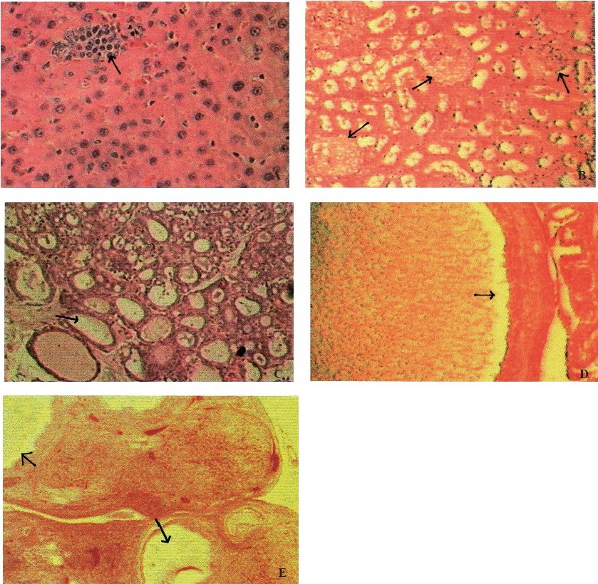 Photomicrograph of lesions observed in various organs of WNIN/GR-Ob rats. (A) Focal areas of necrosis in liver; (B) Glomerular necrosis in kidney; (C) Follicles devoid of colloid in thyroid; (D) Pus cells in uterus cavity; (E) Cystic ovary with corporalutea. (Lesions represented by arrows).