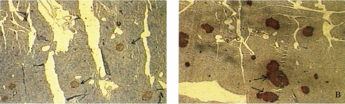 Photomicrograph of immunohistochemistry details of pancreatic islets of WNIN/GR-Ob rats. (A) Islet density in lean; (B) Islet density in obese rats. (Islets represented by arrows).