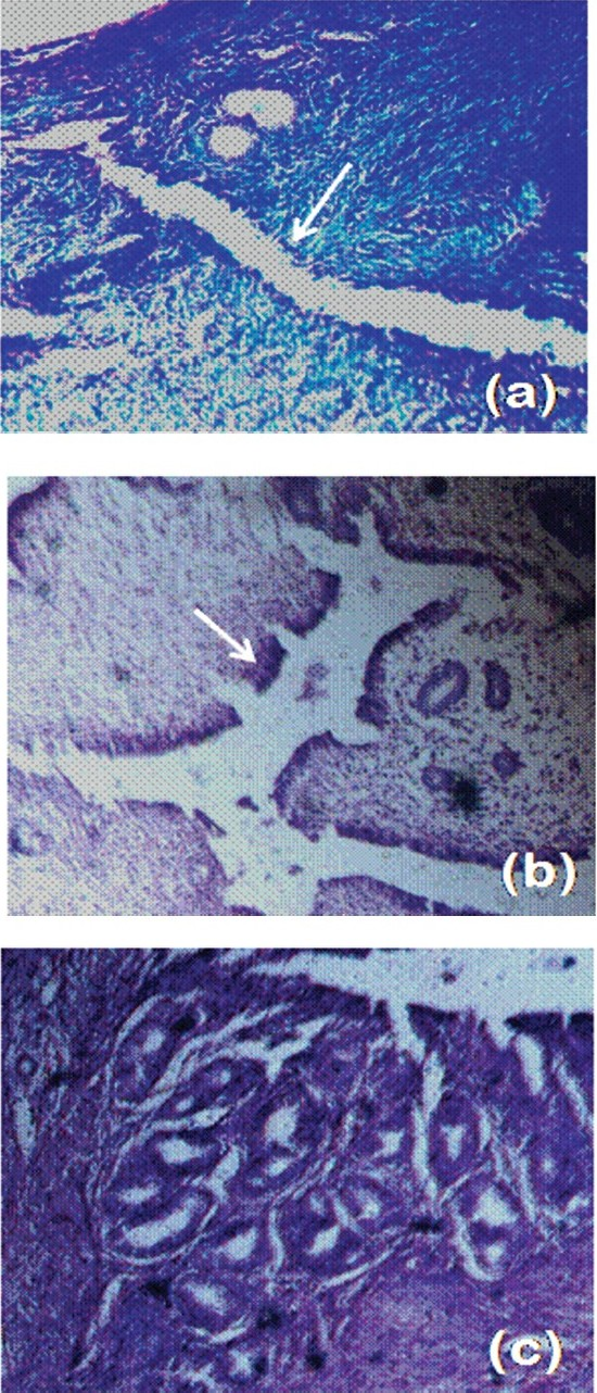 Photomicrographs of Heamatoxylin and Eosin (H&E) stained sections of ovariectomized Swiss albino mice. (a) Water vehicle (control); (b & c) treatment with 100 mg/kg of body wt of SNGF; (b) arrow shows increase in luminal epithelial cell height compared to control; (c) increase in gland number in response to SNGF (10X magnification).