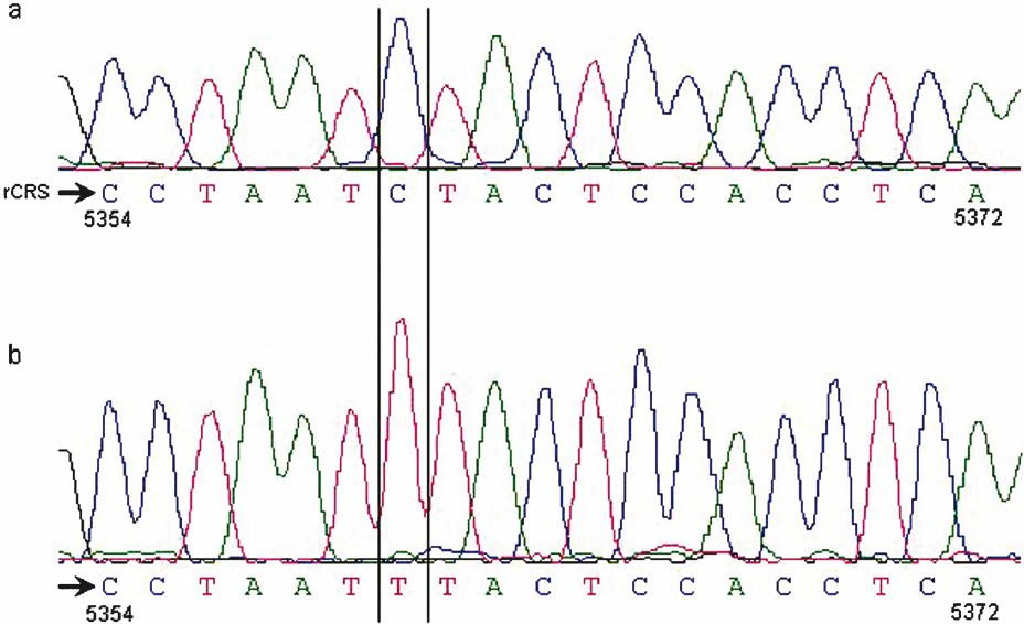 (a) rCRS-revised Cambridge Reference Sequence nucleotide positions 5234 to 5372 were corresponding to the Fig. 1 of Shamsi et al8; (b) Nucleotide variants noticed by Shamsi et al8 in the oligoasthenoteratozoospermia case.