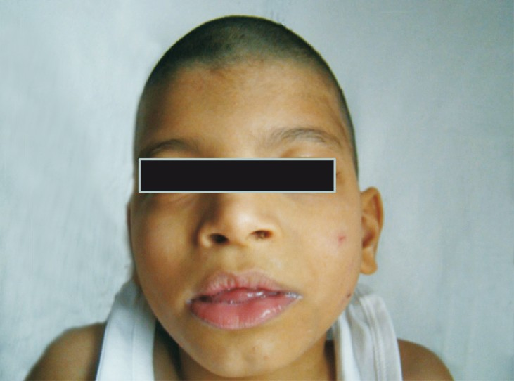 Facial features case 1.