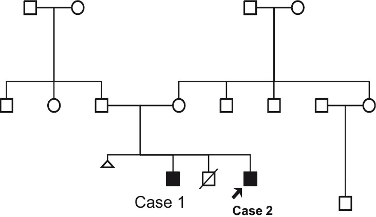Three generation Pedigree.
