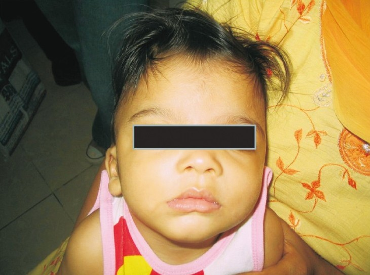 Facial features case 2.