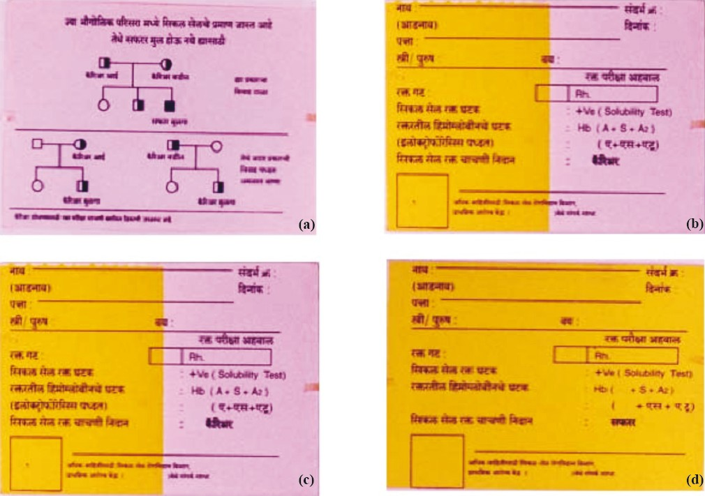 Colour coded genetic cards showing different shades for different genotypes identified at individual level. (a): Full pink report card for HbAA (Normal) with sketch representation of pattern of inheritance of HbS gene on the back side. (b) & (c): Half-pink-half-yellow report cards for HbAS (heterozygote). (d): Full yellow report card for HbSS (SCD) patient.