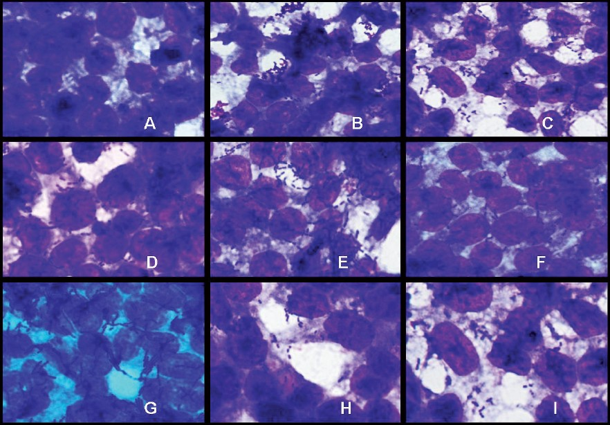 Adhesion of Lactobacillus strains on HT-29 cell cultures observed under oil immersion microscope (100X) after staining with Geimsa strain. A-Blank HT-29 cell line, B-L. plantarumCSCC 5276, C- L. plantarumLp91, D-L. plantarumLp9, E-L. plantarumLp72, F-L. plantarumLp75, G- L. plantarumLp77, H- L. plantarumLp90, I- L. delbrueckiisubsp. bulgaricusCH4.