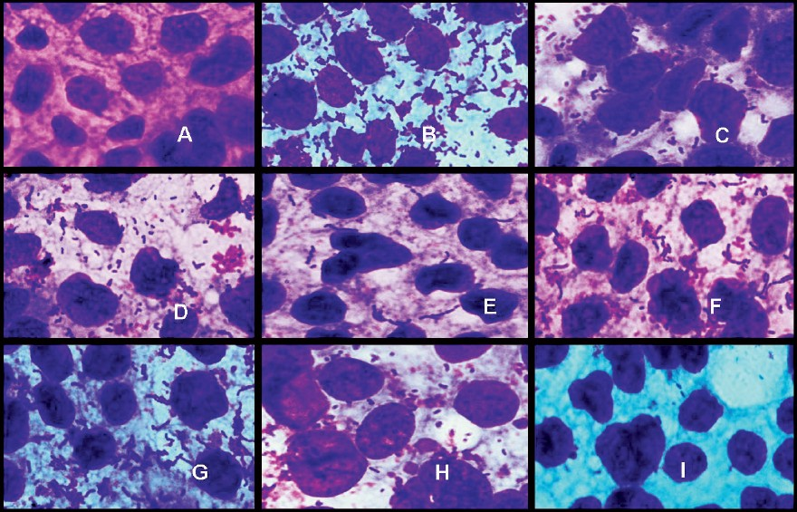 Adhesion of Lactobacillus strains on Caco2 cell cultures observed under oil immersion microscope (100X) after staining with Geimsa strain. A-Blank Caco2 cell line, B- L. plantarumCSCC 5276, C- L. plantarumLp91, D- L. plantarumLp9, E- L. plantarumLp72, F- L. plantarumLp75, G- L. plantarumLp77, H- L. plantarumLp90, I- L. delbrueckiisubsp. bulgaricusCH4.