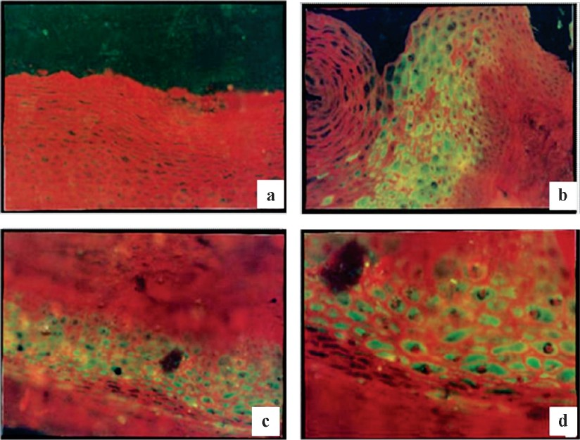 Immunofluorescent staining of normal ectocervix; a (10X), stratified squamous epithelial cells stained with rabbit pre immune serum as negative control; b, c (20X) & d (30X) stratified squamous epithelial cells stained with hyperimmune serum raised against 2 kDa peptide.