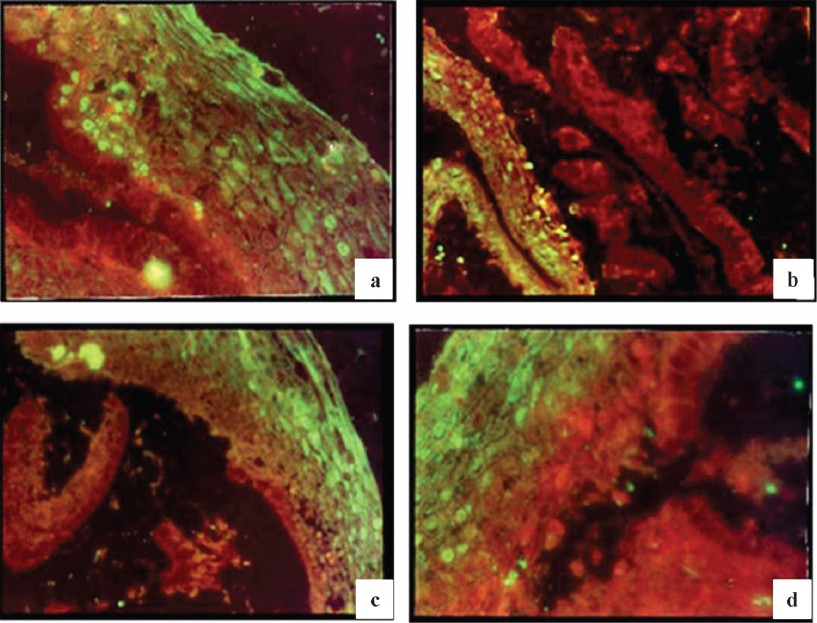 Immunofluorescent staining of inflamed cervix (stratified squamous epithelial cells) from patient with chronic non-specific cervicitis using hyperimmune serum raised against 2 kDa peptide; a & d (30X), b & c (30X).