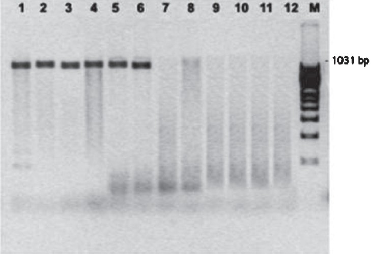 PCR amplification of the vanA gene for vancomycin resistance in methicillin resistant S. aureus. Lanes 1-6 vanA positive VRSA; Lane 7: vanA negative VRSA and Lanes 8-12: vanA negative VSSA, M-100 bp ladder.