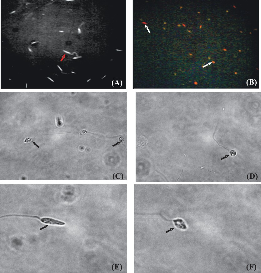 PI stained promastigotes were photographed using a microscope with an Olympus microphotographic system (A) untreated cells at 400X using a light microscope, (B) plumericin treated cells detected in the orange range of 562-588 nm band pass filter at 400X using fluorescence microscope, and (C, D, E & F) plumericin treated cells showing deformities at 400X using a light microscope. Arrows show (A) live cells, (B) dead cells, (C-F) deformed cell morphology.