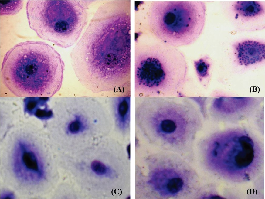 Giemsa stained cells were photographed at 1000X magnification using a light microscope with an Olympus microphotographic system (A) Uninfected macrophages, (B) Untreated infected macrophages showing amastigotes within macrophages, and (C & D) amphotericin B and plumericin treated infected macrophages respectively, showing clearance of amastigotes.