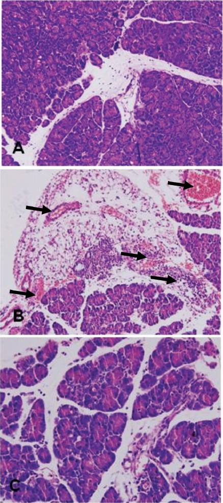 Pathological changes in the mouse pancreas (HE staining, 200X). A: Pancreatic histopathology in control group. B: Pancreatic histopathology in AP group. C: Pancreatic histopathology in curcumin group.