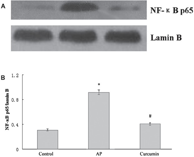 Effect of curcumin on nuclear NF-κB expression in the pancreas of AP mice. (A) Western blot analysis of nuclear NF-κB expressionin in pancreas. (B) The graph shows densitometric analysis of the NF-κB relative to lamin B. *P<0.05 vs control group; #P<0.05 vs AP group. Values are mean±SD of 10 mice/group.