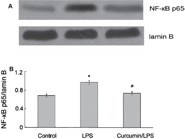 Effect of curcumin on NF-κB expression in RAW264.7 cells. (A) Western blot analysis of NF-κB expressionin in RAW264.7 cells. (B) The graph shows densitometric analysis of the NF-κB relative to lamin B. *P <0.05 vs control group; #P<0.05 vs LPS group. Values are mean±SD (n=3).