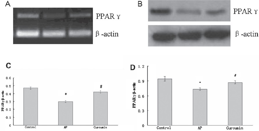 Effect of curcumin on PPARγ expression in the pancreas of AP mice. (A) RT-PCR analysis of PPARγ mRNA expression in the pancreas. (C) The graph shows densitometric analysis of PPARγ relative to β-actin. *P<0.05 vs control group; #P<0.05 vs AP group. (B) Western blot analysis of PPARγ protein expression in the pancreas. (D) The graph shows densitometric analysis of PPARγ relative to β-actin. *P<0.05 vs control group; #P<0.05 vs AP group. Values are mean±SD of 10 mice / group.