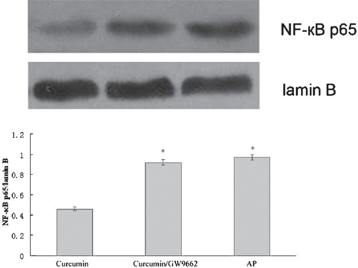 Effect of curcumin plus GW9662 on nuclear NF-κB-p65 protein levels in the pancreas. *P<0.05 vs curcumin group.