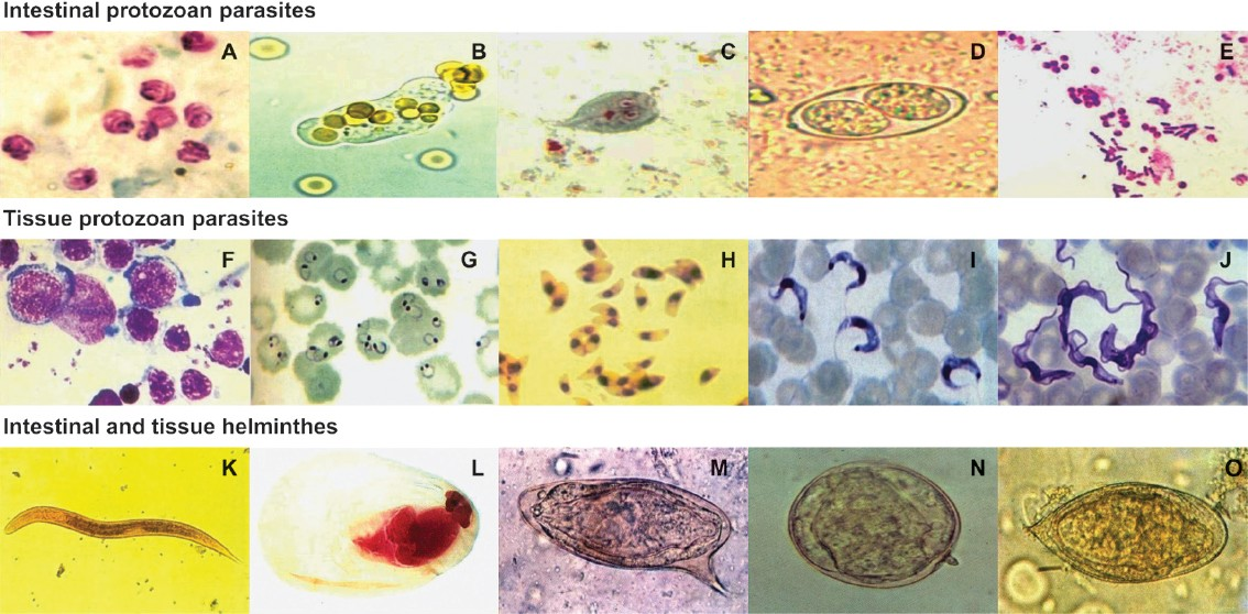 Microscopic images from clinical samples. (A) Oocysts of Cryptosporidium parvumfrom a stool sample (Modified acid-fast stain). (B) Trophozoite of Entamoeba histolyticafrom a fresh stool sample. (C) Trophozoite of Giardia intestinalisfrom a stool sample (Trichrome stain). (D) Oocyst of Isospora belli from a stool sample. (E) Spores of Microsporidiam spp. from a stool sample (Gram-chromotrope stain). (F) Oval-shaped Leishmania donovani amastigotes from a bone marrow aspirate (Giemsa stain). (G) Ring form of Plasmodium falciparum from a blood smear (Giemsa stain). (H) Trophozoites of Toxoplasma gondii from intra-peritoneal fluid (Giemsa stain). (I) Monomorphic trypomastigotes of Trypanosoma cruzi in a blood smear (Giensa stain). (J) Polymorphic trypomastigotes of Trypanosoma brucei gambiense in a blood smear (Giemsa stain). (K) Rhabditiform larva of Strongyloides stercoralis from a stool sample. (L) Cysticercus cellulosae (Carmine and fastgreen stain). (M) Egg of Schistosoma mansonifrom a stool sample. (N) Egg of Schistosoma japonicum from a stool sample. (O) Egg of Schistosoma haematobium from a stool sample. Magnifications: (A-J)=1000 ×, (K, L)=100 ×, (M-O)=400 ×.