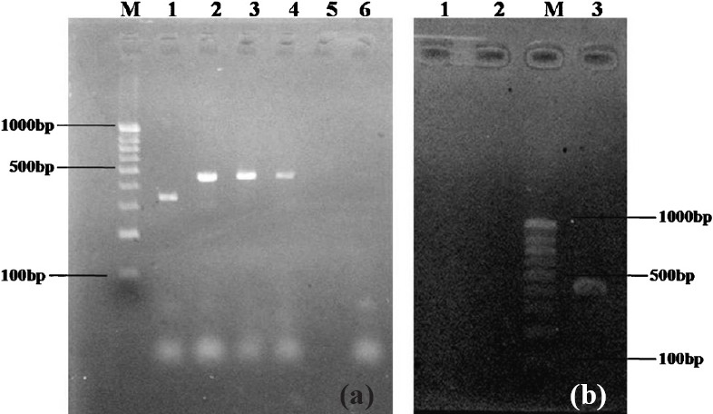 PCR for Plasmid-encoded AmpC β-lactamase genes: 2 per cent Agarose gel showing products of PCR amplification. (a) M-100bp molecular size standard DNA ladder. Lane 1-E.coli with 342bp ACC gene, Lane 2-K. pneumoniae with 462bp CIT, Lane 3 & 4 -E. colishowing 462bp CIT gene, Lane 5- negative K. pneumoniae & Lane 6- negative water control. (b) Lane 1-negative K. pneumoniae, Lane 2- negative water control, M-100bp molecular size standard DNA ladder, Lane 4- E.coli with 405 DHA positive, the 520bp MOX gene was not shown in the figure.
