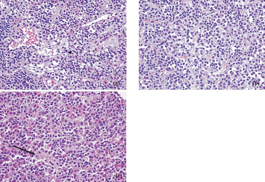 a. Control group adenohypophysis. HE × 400. b. Hyperemic adenohypophysis of pre-pubertal male rats exposed to 39° C hyperthermia. HE × 400. c. Hydropic degeneration and focal necrosis (arrow) in the adenohypophysis of pre-pubertal male rats exposed to 41° C hyperthermia. HE × 400.