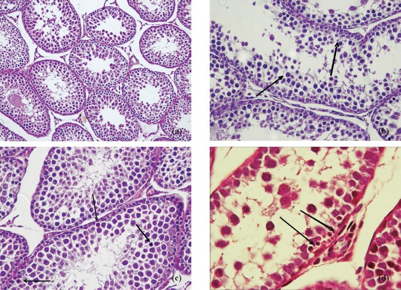 a. Normal maturation of germ cells in the seminiferous tubules in the control group. HE × 200. b. Hydropic swelling in germ cells in the seminiferous tubules of pre-pubertal male rats exposed to 39°C hyperthermia. HE × 400. c. Presence of apoptotic germ cells (arrow) in the seminiferous tubules of pre-pubertal male rats exposed to 41°C hyperthermia. HE × 400. d. Presence of apoptotic germ cells (arrow) in the seminiferous tubules of pre-pubertal male rats exposed to 41°C hyperthermia. HE × 400.