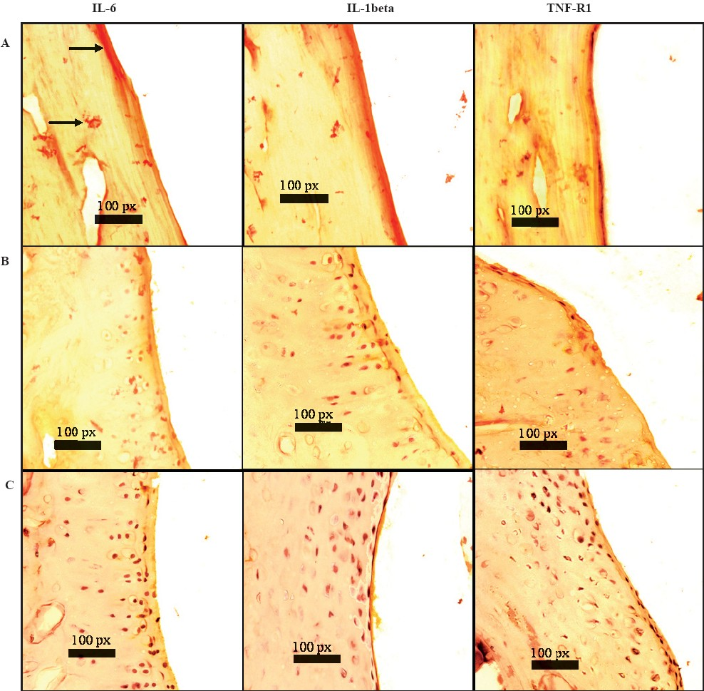 Effect of CSHE treatment on cytokine/cytokine receptor expression in rat synovial joint: Sections were 6 μm thick and photomicrographs were taken at 40X. CSHE = C. sativum hydro-alcoholic extract. A = control animal; B = indomethacin treated animal; C = CSHE (32 mg/kg) treated animal; Bold arrows = DAB staining (yellow-brown) of the synovial membrane depicting presence of respective cytokines.