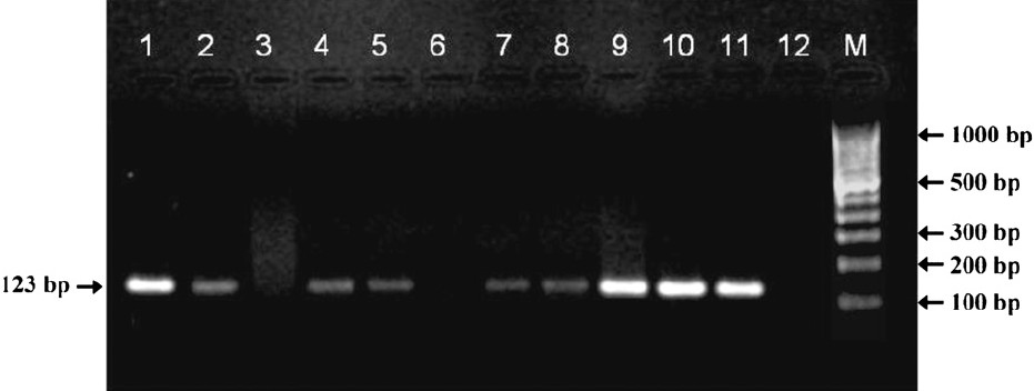 Agarose gel electrophoresis of IS 6110 based Polymerase chain reaction for detection of M. tuberculosis from sputum specimens. Lane 1= positive control from M. tuberculosis H37Rv; Lanes 2, 4, 5, 7, 8, 9, 10, 11= PCR positive; Lanes 3 and 6= PCR negative; Lane 12=negative control; M= molecular weight marker.