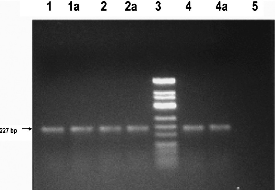 Gel photograph of Apo E amplified gene. Agarose gel (2%) showing a 227 bp amplified product of Apo E gene. Lane 1, 2 & 4 amplified gene from direct blood extracted DNA samples; Lane 1a, 2a & 4a amplified gene from respective dried blood extracted DNA samples; Lane 3 ΦX174DNA/HinfI marker; Lane 5 - ve control (without genomic DNA).