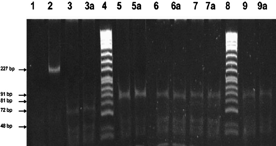 Apo E polymorphism in corresponding blood with dried blood on the day of collection (n=55). Polyacrylamide gel (10%) photograph of HhaI digested amplified Apo E gene. Lane 1 - ve control (without genomic DNA); Lane 2 Undigested amplified 227bp apo E gene; Lane 3 and 3a E4/E4 genotype blood and dried blood sample; Lane 4 ΦX174DNA/HinfI marker; Lane 5 and 5a E3/E3 genotype blood and dried blood sample; Lane 6 and 6a E3/E3 genotype blood and dried blood sample; Lane 7 and 7a E2/E3 genotype blood and dried blood sample; Lane 8 ΦX174DNA/HinfI marker; Lane 9 and 9a E2/E2 genotype blood and dried blood sample.