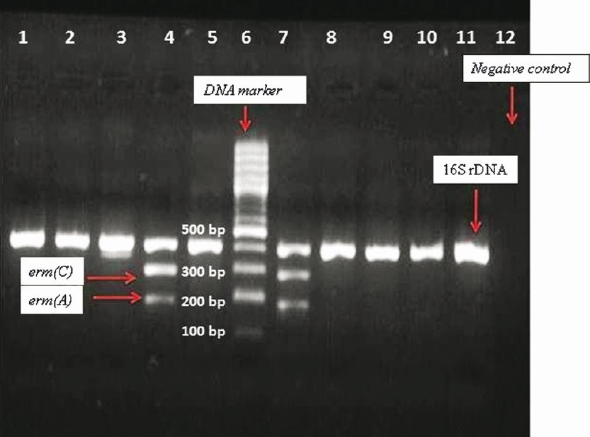 Ethidium bromide-stained multiplex PCR products after gel electrophoresis for the 16S rDNA (420 bp), erm(A) (190 bp) and erm(C) (299 bp) genes. DNA molecular size marker (100 bp). Lanes: 1-5, and 7-11; 16S rDNA; Lane 4 and 7: 16S rDNA, erm(A) and erm(C); Lane 6: DNA marker (molecular size standard); Lane 12: Negative control.