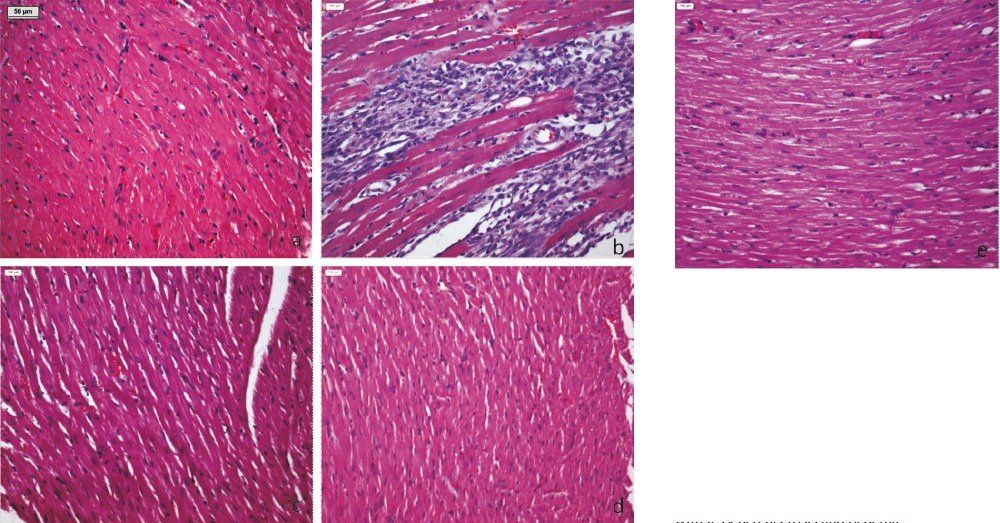 Light micrograph (H&Ex100) of rat's myocardium (a) Sham group showing normal histoarchitecture of myocardium, (b) I-R control group showing confluent necrosis of myofibrils, edema and infiltration of inflammatory cells with extravasations of red blood cells, (c) Benazepril 30 mg/kg showing reduced myonecrosis, oedema and infiltration of inflammatory cells, (d) A. paniculata 200 mg/kg pretreatment showing normal histoarchitecture of myocardium and (e) A. paniculata 200 mg/kg + I-R group showing resemblance to normal myocardial histoarchitecture with lessened necrosis and oedema.