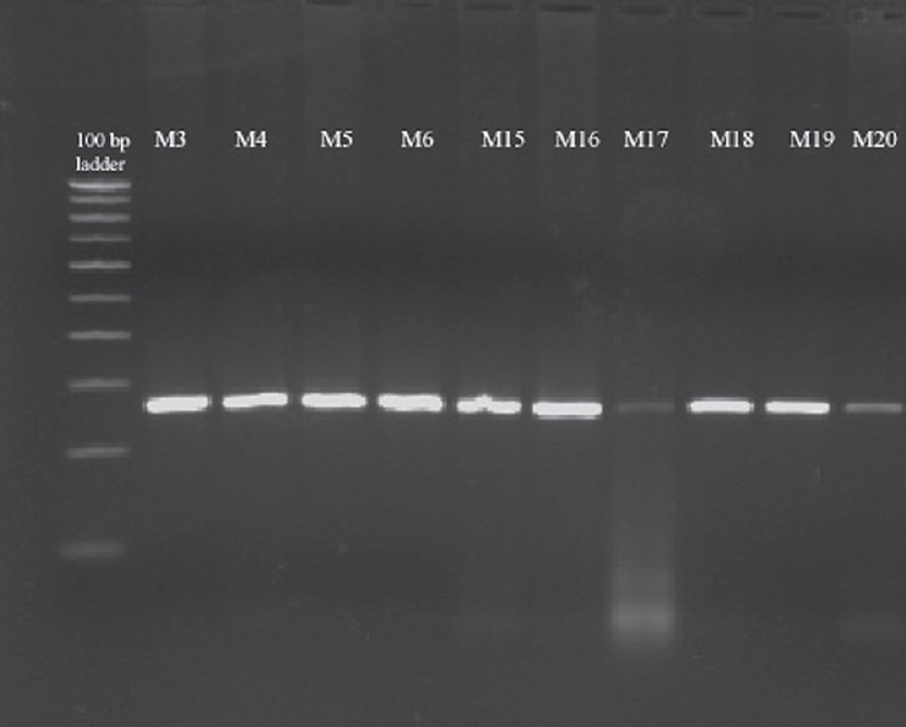 Restriction fragment length polymorphism analysis of pfcrt. Representative agarose gel electrophoresis of the pfcrt K76T polymorphism. Presence of the K76T mutation was detected using the ApoI restriction enzyme. ApoI does not cut the mutant allele (lanes 2-17 up & 2-7 down). Lane 1, 100 bp ladder. Lanes 2-17 = Samples M3, M4, M5, M6, M15, M16, M17, M18, M19, M20, M21, M22, M23, M24, M25 Lanes 2-7 = Samples M26, M27, M28, M29 M30, M39.