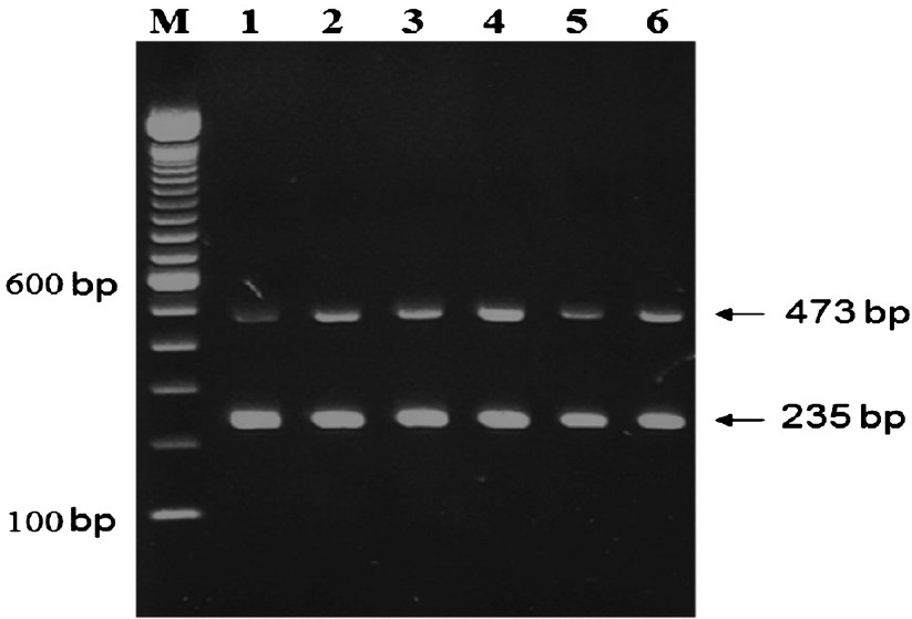Representative agarose gel of multiplex PCR products from six selected multidrug-resistant isolates (lanes 1-6) showing M. tuberculosis-specific amplification of 473 bp and 235 bp fragments (marked by arrows) of oxyR and rpoB genes, respectively. Lane M is 100 bp DNA ladder and the position of migration of 100 and 600 bp fragments are marked.