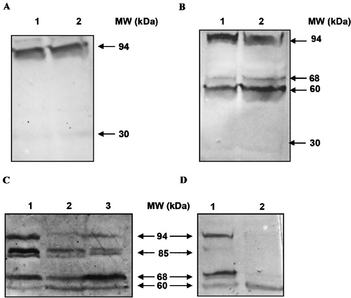 Characterization of the monoclonal antibodies used in the study. Western blot using 3 monoclonal antibodies against calpain-3 in muscle biopsies are shown. (A) Western blot with Ab-1 [lanes 1 & 2 correspond respectively to 10 & 20 μl of muscle extract from the positive control (PME)]. (B) western blot with Ab-2 [lanes 1 & 2 correspond respectively to 10 & 20 μl of muscle extract from PME]. (C) western blot with Ab-3 (Lanes 1-3 correspond 10 μl each of the total extract from 3 dystrophic muscle samples, respectively). (D) Western blot with Ab-2 (lanes 1 & 2 correspond to 10 μl each of the total extract from PME and normal autopsy muscle respectively). The protein molecular weights (MW) in kDa in each blot are shown.