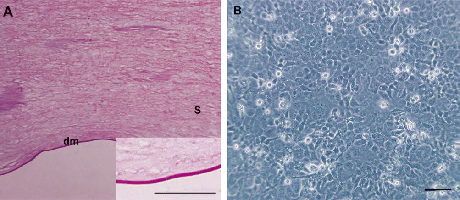 Microscopic images of APCM and B4G12 cells. (A) HE staining showed that the acellular porcine corneal matrix was cell-free and the collagen structure was preserved. A high magnification image of APCM is shown in the lower right corner. (B) Monolayer of B4G12 cells formed after 72 h of sub-cultivation. Scale bars: A=50 μm, B=100 μm. dm= Descemet's membrane; s= stroma.
