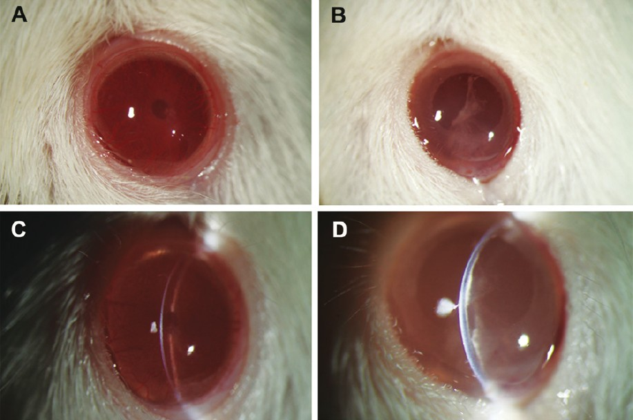 Representative corneal photos after the surgery. (A) Cornea in the B4G12 cell-injection group was clear, the anterior chamber and the iris were clearly visible. (B) In contrast, cornea in the cryoinjury only group was opaque. (C) The slit image of the cornea in the B4G12 cell-injection group showed that the cornea was at normal thickness, and the endothelium surface was smooth. (D) The slit image of the cornea in the cryoinjury only group showed that the cornea was swollen and there was lamellar keratic precipitate on Descemet's membrane.