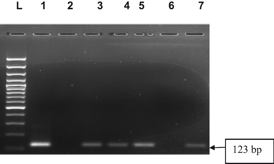 IS6110PCR-based detection of M. tuberculosis complex. Electrophoretic separation of the amplicon into 2% agarose gel is documented across lanes 1-7. The presence of a 123 bp amplicon in lanes 3, 4, 5, 7 indicated the presence of the target while the absence of the amplicon in lane 6 showed absence of the target. Lane 2 was negative control and lane 1 was positive control (H37Rv). L-Ladder 100 bp was well shown.