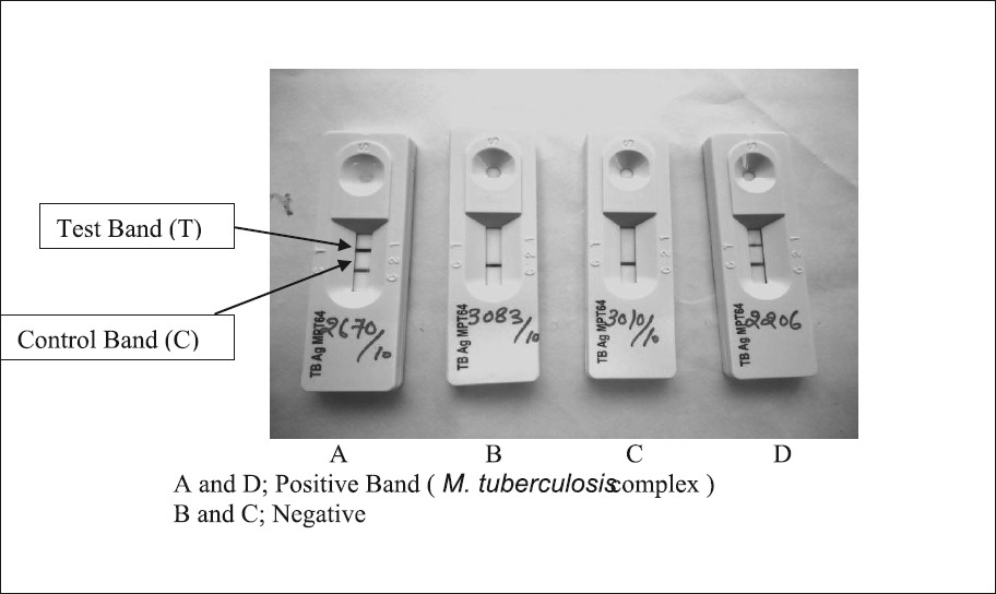 Identification M. tuberculosis complex by MPT64 Rapid ICT kit.